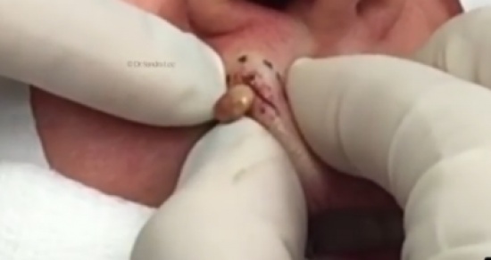 فيديو| أهملت الرؤوس السوداء لتتحول الى أمر خطير!