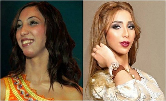 فيديو| النجمة 'دنيا بطمة' تفاجئ متابعيها بما قالته بهذا الخصوص! فيديو| النجمة 'دنيا بطمة' تفاجئ متابعيها بما قالته بهذا الخصوص!