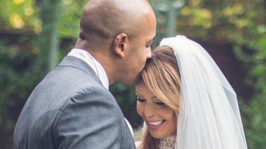 بالصور .. عارضة أزياء احترق وجهها فخضعت ل 40 عملية تجميل .. شاهد الفرق