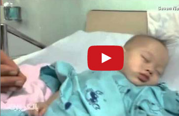 عائلة تأخذ طفلها السليم من توأم وتتخلى عن المعاق