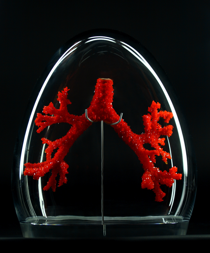 pollution sensing lung tumor