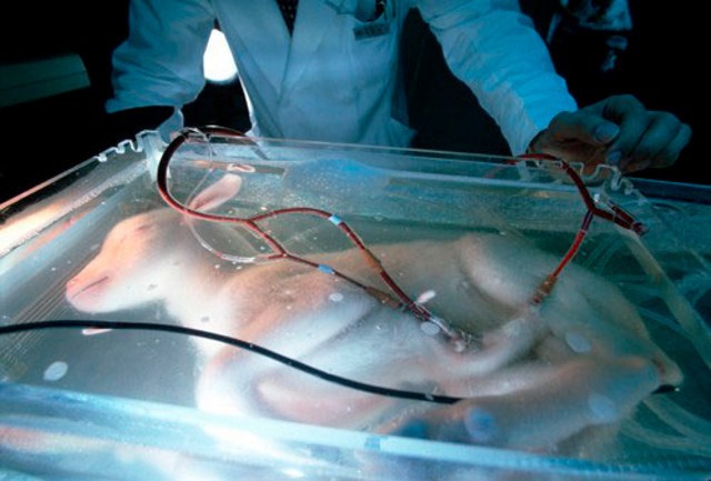 Artificial Womb