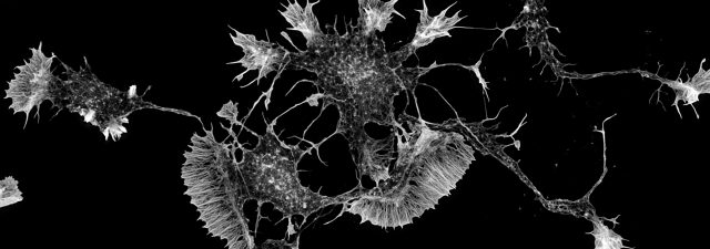 Scan of neurons connected