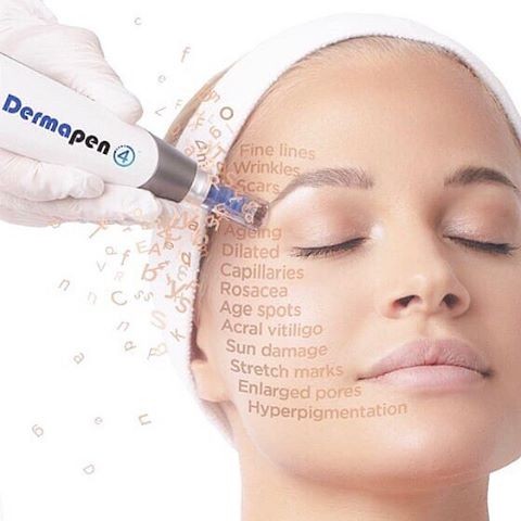 laser skincare göteborg omdöme laser skincare göteborg omdöme
