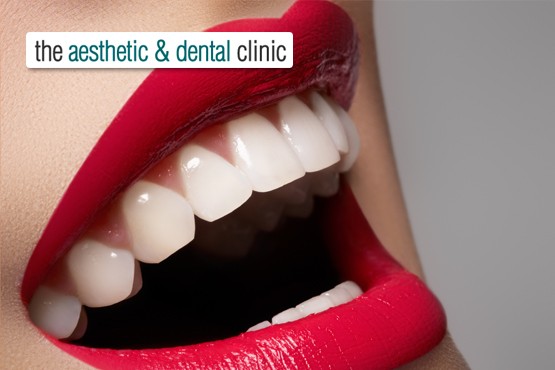 £750 instead of £2000 for either a top or bottom invisible brace inc. a consultation at The Aesthetic and Dental Clinic, Shrewsbury - save 62%