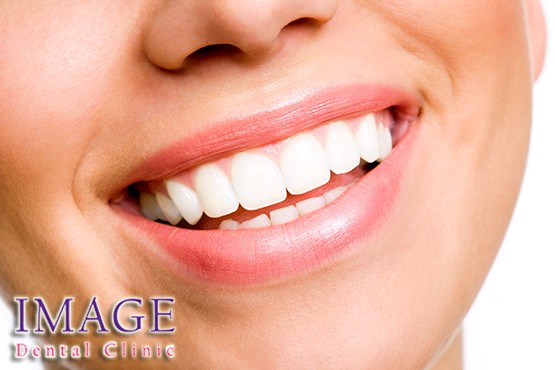 £99 instead of £450 for a teeth whitening treatment at Image Dental Clinic, Marylebone– make that smile sparkle and save 78%