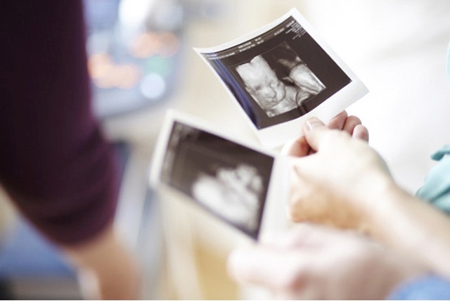 £99.99 instead of £250 for a 4D baby scan with optional sex determination, 8 images & DVD at the Baby Scan Clinic, Harley Street - save 60%