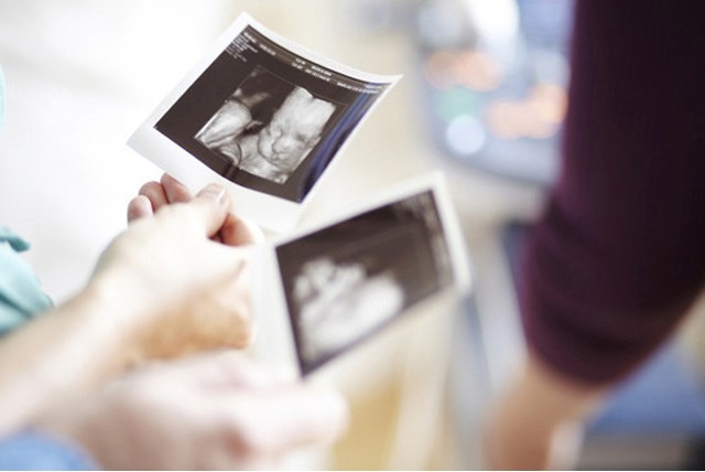 £99.99 instead of £250 for a 4D baby scan with optional sex determination, 6 images & DVD at the Baby Scan Clinic, Harley Street - save 60%