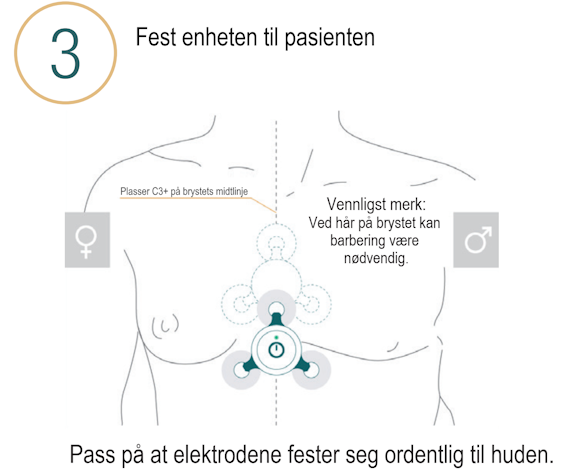 Åpne kort manual