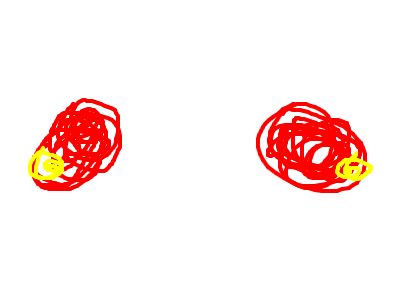 blinking lights