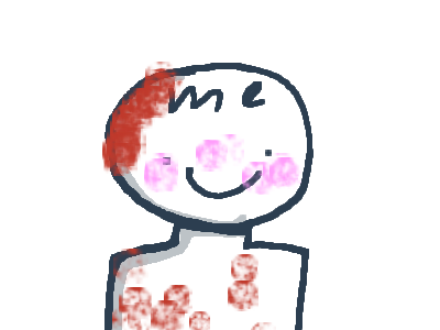 Stop hitting MySeLf :)