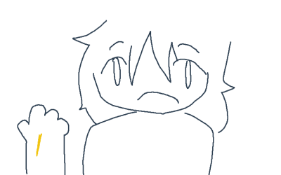 uhhh guys- I think I have jaundice