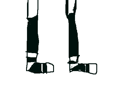 .............DIE.........