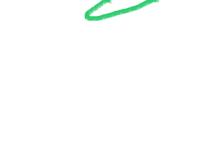 My arms look like tentacles