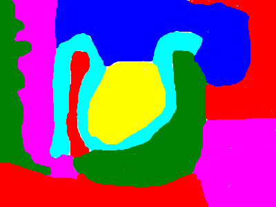 Seizure Simulator