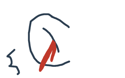 had a vision my ear bled..is this foreshadowing?