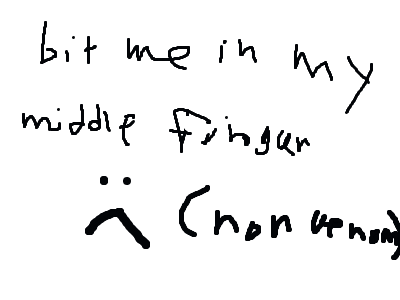 im sad one of meh snek bit meh