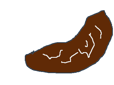 the blight has murdered this potato