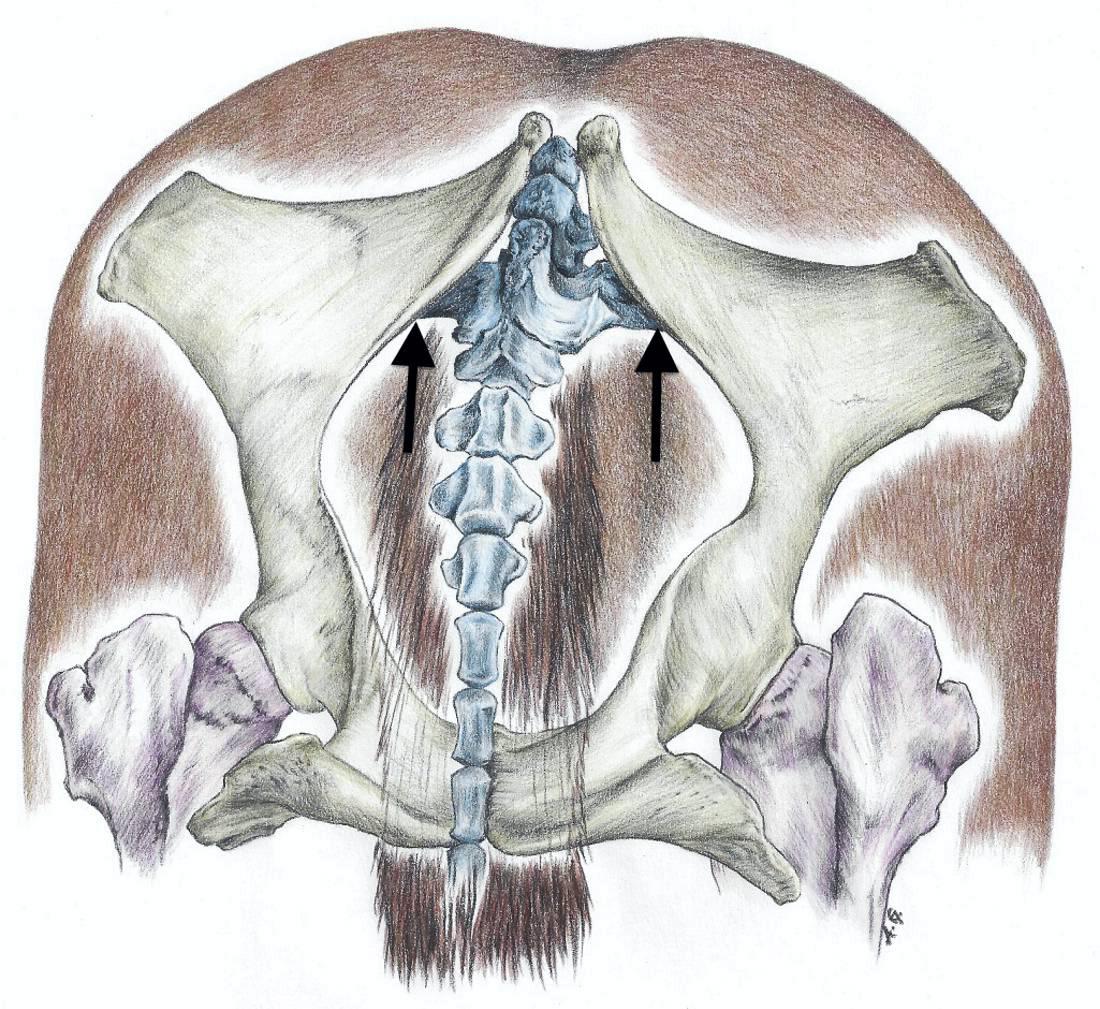 Explaining equine osteopathy