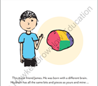 The Boy with a Different Brain