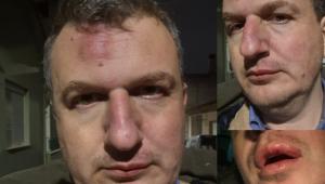 Αγριος ξυλοδαρμός εκδότη