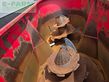 Remolqu esparcidor -  - peecon airmix biga 20-215 rapide zelfrijder
