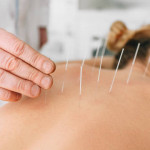 José Ramón Garre, Acupuncturist in Murcia