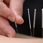 Jordi Mula, Acupuncturist in Barcelona