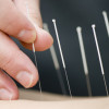 Fran Mago, Acupuncturist in Villena