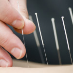 Fran Mago, Acupuntor a Villena