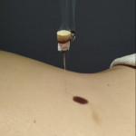 Sergio Mutilva, Acupuncturist in Barcelona