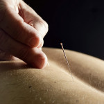 Felipe García, Acupuntor en Sant Cugat del Vallès