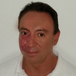 Rafa Ts, Acupuntor a Rocafort