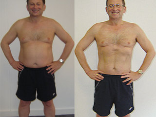 Before-after-tony_medium
