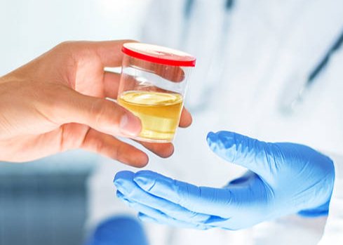 TROD angine et tests urinaires en pharmacie