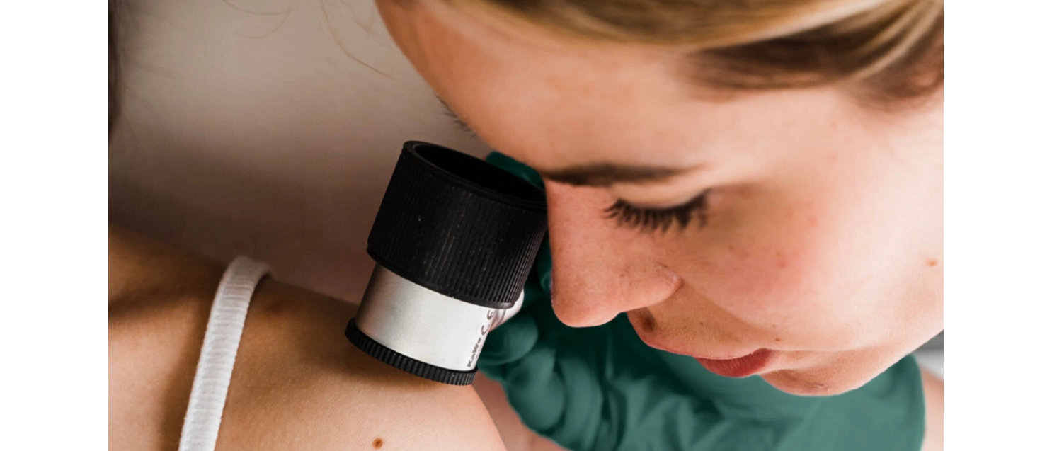Téléexpertise dermatologique en pharmacie