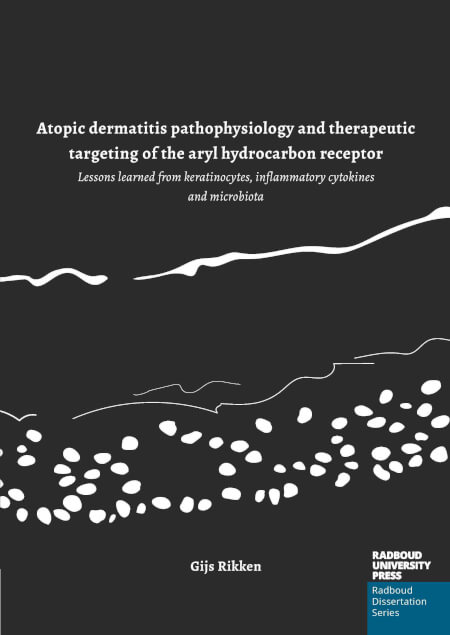 Boek cover Atopic dermatitis pathophysiology and therapeutic targeting of the aryl hydrocarbon receptor
