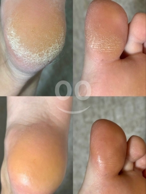 body scrub — 2