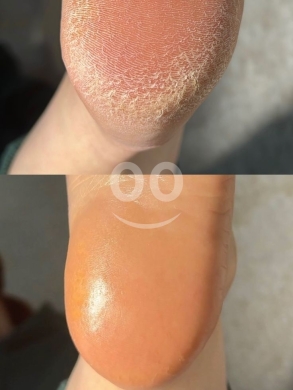 body scrub — 3
