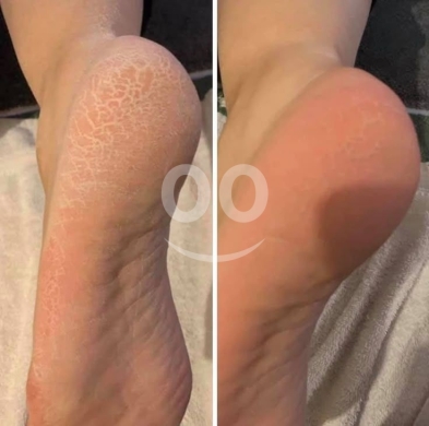 body scrub — 4