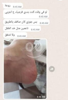 كريم لابيتاك المتطور لإصلاح تشققات القدمين والكعبين | Lapitak Heel Repair Cream for Crack… — 5