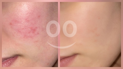 Health & Beauty in Teffahta - استشارات خاصة بالعناية بالبشرة،انشاء روتين مناسب مع متابعة النتائج