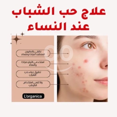 Goodbye Acne, Hello Glow! - وداعاً لحب الشباب، مرحباً بالبشرة المشرقة — 3