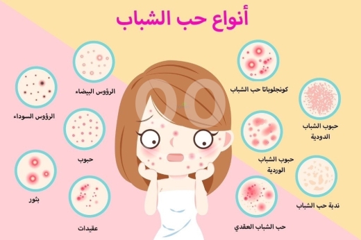 Goodbye Acne, Hello Glow! - وداعاً لحب الشباب، مرحباً بالبشرة المشرقة — 2