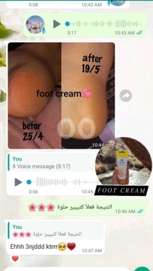 الصحة والجمال بمنتجات طبيعية لعلاج تشققات القدمين والرائحة الكريهة — 7