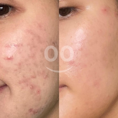 سيروم حمض الهيالورونيك المرطب لتجديد نضارة البشرة | Hyaluronic Acid Serum for Hydration &… — 4