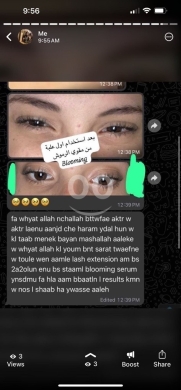 مصل الرموش والحواجب "Maximum Volume" - سر العيون الجذابة — 7