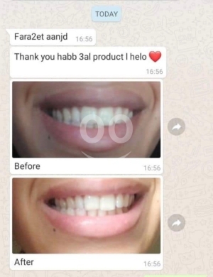 تبييض احترافي في دقائق: نتائج ملحوظة من أول استخدام. — 2