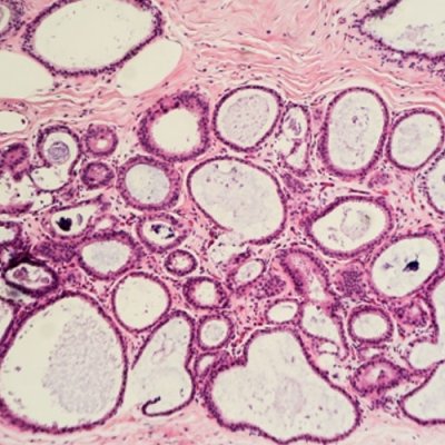 TANBead Tissue Total RNA, Auto Plate, RUO, 6K2 series, M6K2A46, 96 Tests; MOQ of 4