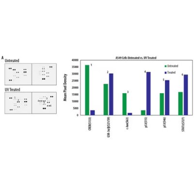 Array Kit, Proteome Profiler Human Phospho-Kinase Array Kit, 1 Kit